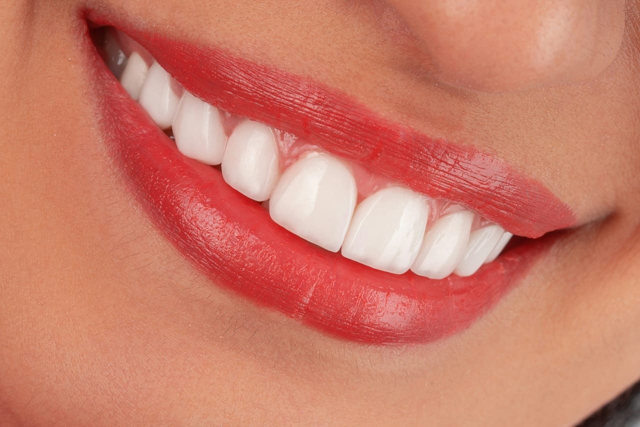 A close-up of a natural, well-proportioned smile after cosmetic treatment