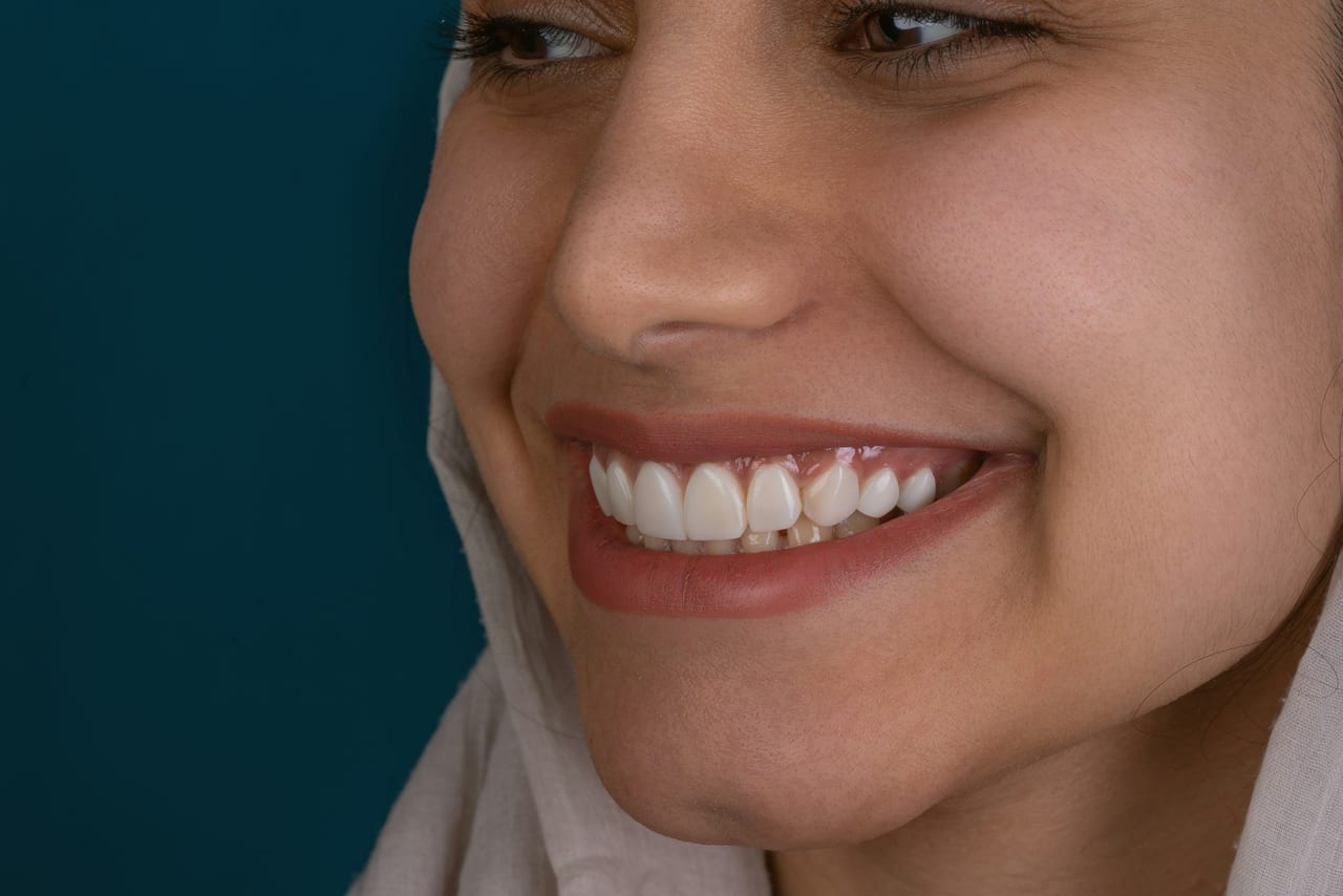 A patient smiling after a full cosmetic smile transformation
